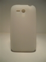 Picture of Nokia Freestyle White Gel Case